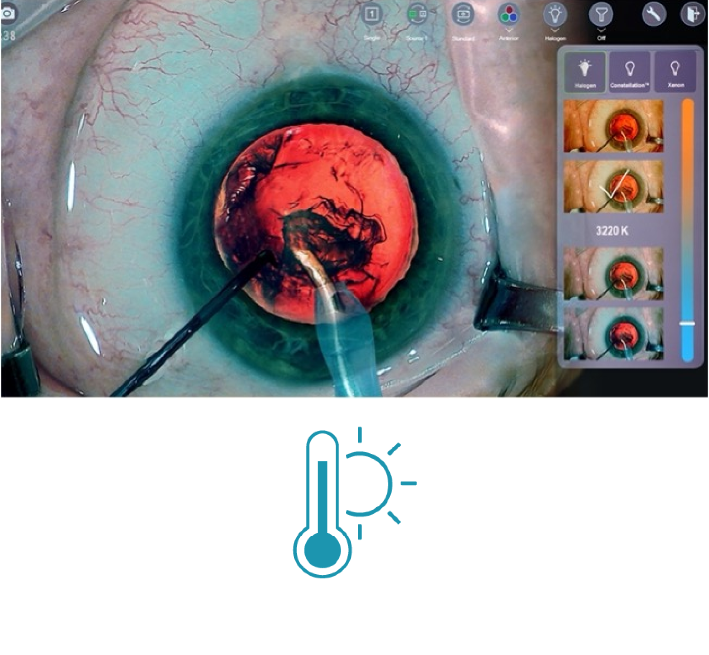 手術中の目のクローズアップ画像、画面には手術道具が表示されている。 画面右側のサムネイルには、NGENUITY 3Dビジュアリゼーションシステムで利用できる様々な光温度フィルターが表示されている